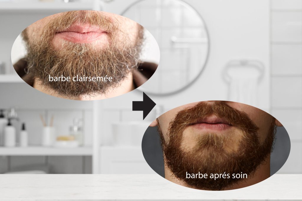 Conseils pour prendre soin dune barbe clairsemee detail 01 2048x1365 1