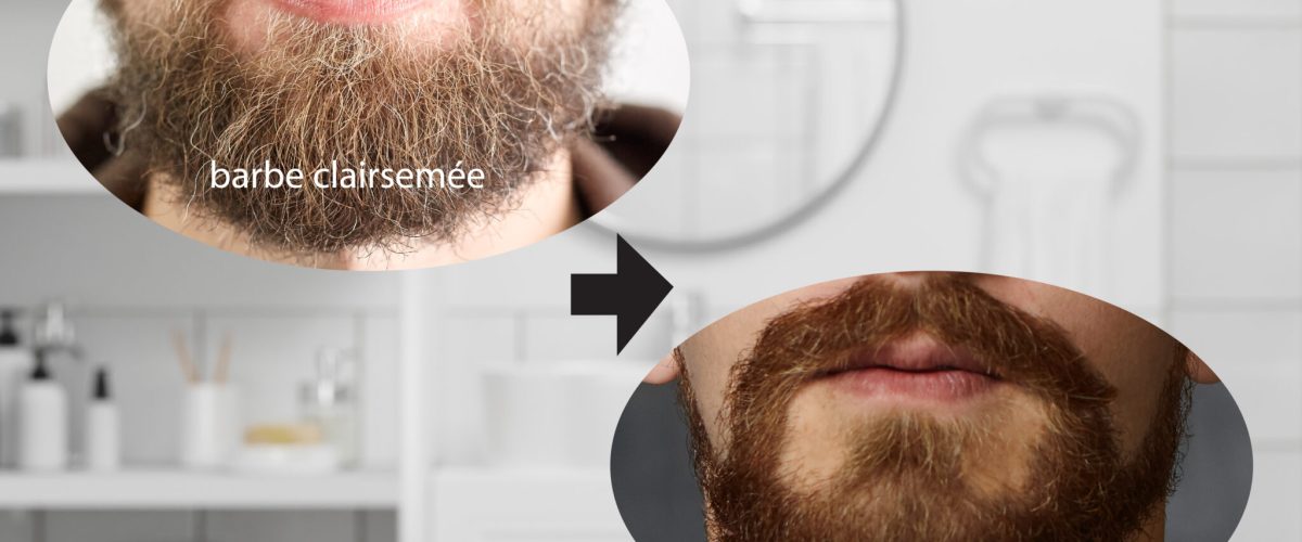 Conseils pour prendre soin dune barbe clairsemee detail 01 2048x1365 1 1200x500