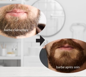 Conseils pour prendre soin dune barbe clairsemee detail 01 2048x1365 1 360x320